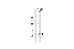 All lanes : Anti-RGR Antibody (Center) at 1:1000 dilution Lane 1: HL-60 whole cell lysate Lane 2: NC-1 whole cell lysate Lysates/proteins at 20 μg per lane. (RGR antibody  (AA 265-291))