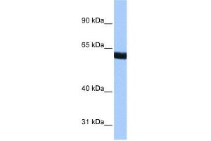 WB Suggested Anti-ZNF350 Antibody Titration:  0.