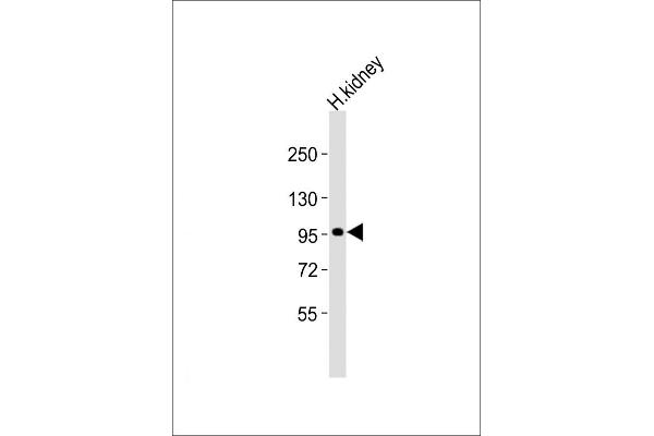 ADAMTS6 Antikörper  (AA 20-54)