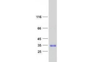 Western Blotting (WB) image for TGFB-Induced Factor Homeobox 2 (TGIF2) protein (Myc-DYKDDDDK Tag) (ABIN2733536)