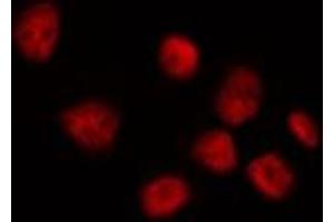 ABIN6278307 staining HepG2 by IF/ICC. (BACH1 antibody  (Internal Region))