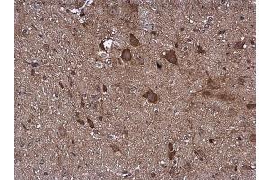IHC-P Image Pyruvate Dehydrogenase E1 beta subunit antibody detects Pyruvate Dehydrogenase E1 beta subunit protein at cytoplasm in mouse brain by immunohistochemical analysis.