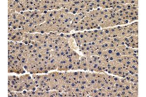 ABIN6257497 and ABIN6275601 at 1/100 staining mouse liver tissue by IHC-P. (Sorting Nexin 3 antibody  (Internal Region))