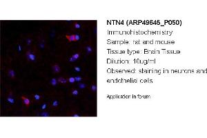 Image no. 2 for anti-Netrin 4 (NTN4) (N-Term) antibody (ABIN2783832)