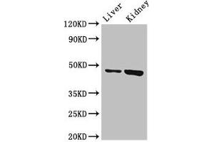 Western Blot Positive WB detected in: Mouse liver tissue, Mouse kidney tissue All lanes: WDFY1 antibody at 3 μg/mL Secondary Goat polyclonal to rabbit IgG at 1/50000 dilution Predicted band size: 47 kDa Observed band size: 47 kDa (WDFY1 antibody  (AA 261-357))