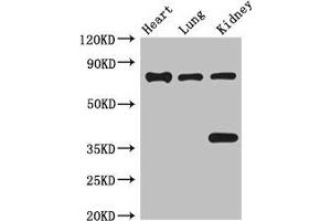 Western Blot Positive WB detected in: Mouse heart tissue, Mouse lung tissue, Mouse kidney tissue All lanes: BRSK1 antibody at 3. (BRSK1 antibody  (AA 426-591))