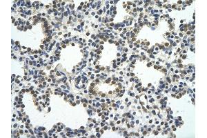 Rabbit Anti-RCOR1 antibody         Paraffin Embedded Tissue:  Human Lung    cell Cellular Data:  alveolar cell    Antibody Concentration:  4. (CoREST antibody  (N-Term))