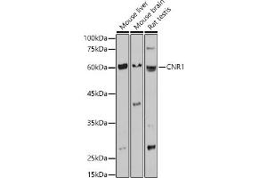 Western blot analysis of extracts of various cell lines, using CNR1 antibody (ABIN1679303, ABIN3015494, ABIN3015496 and ABIN6218536) at 1:1000 dilution. (CNR1 antibody  (AA 1-120))