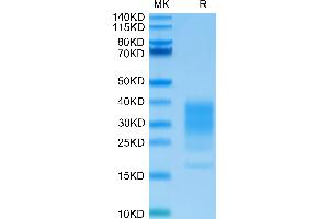 IL-22 Protein (AA 34-179) (His tag)