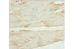 Immunohistochemistry of paraffin-embedded human skeletal muscle tissue using ABIN7144209 at dilution of 1:100 (ANKRD1 antibody  (AA 1-130))