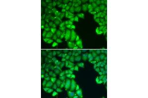 Immunofluorescence analysis of U20S cell using CASP10 antibody. (Caspase 10 antibody  (AA 220-521))