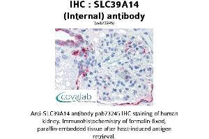 Image no. 1 for anti-Solute Carrier Family 39 (Zinc Transporter), Member 14 (SLC39A14) (Internal Region) antibody (ABIN1739370) (SLC39A14 antibody  (Internal Region))