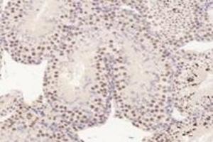 Immunohistochemistry analysis of paraffin-embedded mouse testis using,TADA2B (ABIN7075957) at dilution of 1: 3200