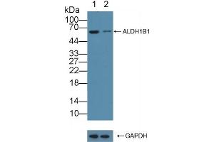 Western Blotting (WB) image for anti-Aldehyde Dehydrogenase 1 Family, Member B1 (ALDH1B1) (AA 18-517) antibody (ABIN7445501)