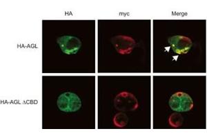 Expression of myc-GS causes wild type but not the ACBD mutant of AGL to aggregate around the S-stain-positive inclusions. (AGL antibody  (N-Term))