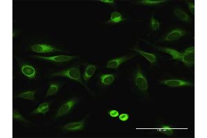 Immunofluorescence of purified MaxPab antibody to EPHX1 on HeLa cell. (EPHX1 antibody  (AA 1-455))