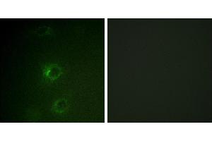 Peptide - +Immunofluorescence analysis of COS7 cells, using CBL (Ab-700) antibody. (CBL antibody  (Tyr700))