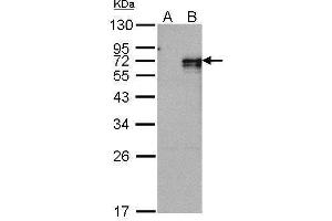 WB Image Western Blot analysis of NR4A1 expression in transfected 293T cell line by NR4A1 polyclonal antibody. (NR4A1 antibody  (C-Term))