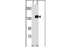 Western blot analysis of PUM1 (arrow) using PUM1 Antibody (Y83) (ABIN391822 and ABIN2841668).