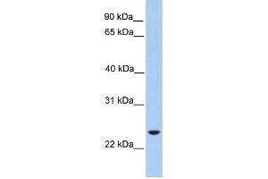ORAI1 antibody used at 1 ug/ml to detect target protein. (ORAI1 antibody  (Middle Region))