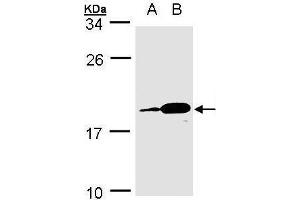 WB Image Sample(30 ug whole cell lysate) A:MOLT4 , B:Raji , 15% SDS PAGE antibody diluted at 1:1000 (MZB1 antibody)