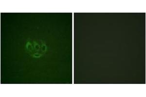 Immunofluorescence analysis of A549 cells, using ACK1 (Phospho-Tyr284) Antibody. (TNK2 antibody  (pTyr284))