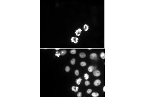 Histone H3S10ph antibody (mAb) (Clone 6G8B7) tested by immunofluorescence. (Histone 3 antibody  (pSer10))
