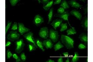 Immunofluorescence of monoclonal antibody to PGM1 on HeLa cell. (Phosphoglucomutase 1 antibody  (AA 1-562))
