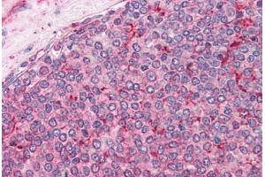 Human Spleen: Formalin-Fixed, Paraffin-Embedded (FFPE) (Calnexin antibody  (AA 109-274))