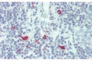 Detection of IL3 in Human Tonsil Tissue using Polyclonal Antibody to Interleukin 3 (IL3) (IL-3 antibody  (AA 20-152))