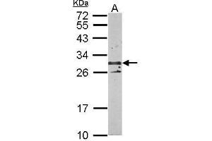 Western Blotting (WB) image for anti-Tetraspanin 3 (TSPAN3) antibody (ABIN2856452)