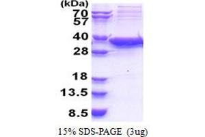 Sirtuin 5 (SIRT5) (AA 34-310) protein (His tag)