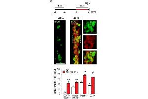 Immunofluorescence (Paraffin-embedded Sections) (IF (p)) image for anti-Red Fluorescent Protein (RFP) antibody (ABIN1607680)