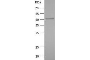 Western Blotting (WB) image for RNA Binding Motif Protein 17 (RBM17) (AA 1-401) protein (His tag) (ABIN7124921) (RBM17 Protein (AA 1-401) (His tag))