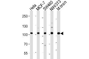 Western blot analysis of lysates from Hela, MCF-7, S, mouse NIH/3T3 cell line, mouse brain tissue lysate (from left to right), using EPHA4 Antibody (Center) (ABIN6243785 and ABIN6577670). (EPH Receptor A4 antibody  (AA 383-417))