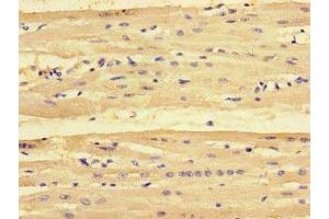 Immunohistochemistry of paraffin-embedded human heart tissue using ABIN7163088 at dilution of 1:100 (NOXA antibody  (AA 1-136))
