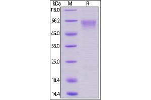SDS-PAGE (SDS) image for CD27 Molecule (CD27) (AA 20-191) (Active) protein (Fc Tag) (ABIN5955004)