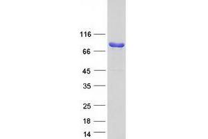 Validation with Western Blot