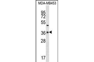 UBE2Z Antibody (C-term) (ABIN1537034 and ABIN2848865) western blot analysis in MDA-M cell line lysates (35 μg/lane). (UBE2Z antibody  (C-Term))