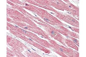 Anti-BECN1 / Beclin-1 antibody IHC of human heart.