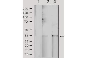 Western blot analysis of extracts from various samples, using NRIP2 Antibody.
