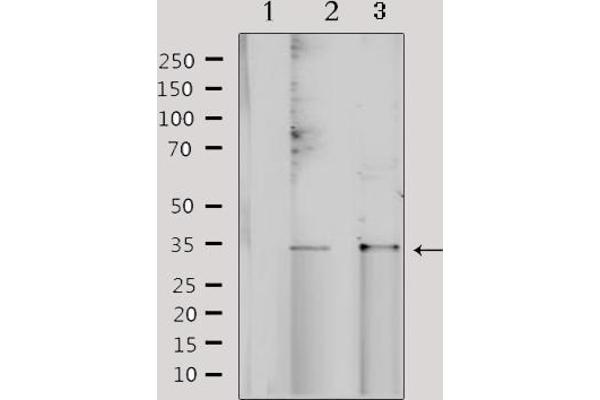NRIP2 Antikörper  (N-Term)