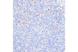 Immunohistochemistry of paraffin-embedded mouse spleen using KCNS3 antibody (ABIN6132153, ABIN6142774, ABIN6142775 and ABIN6223897) at dilution of 1:100 (40x lens). (KCNS3 antibody  (AA 1-180))