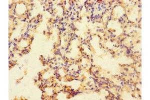 Immunohistochemistry of paraffin-embedded human lung tissue using ABIN7170239 at dilution of 1:100 (SLC35F6 antibody  (AA 337-371))