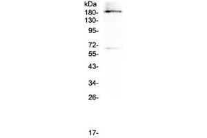 Western blot testing of human U937 cell lysate with Dnmt1 antibody at 0.