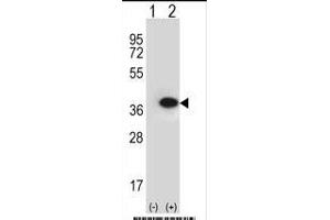 Western blot analysis of ANXA2 (arrow) using rabbit polyclonal ANXA2 Antibody (N-term) (ABIN391619 and ABIN2841538).