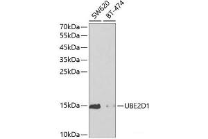 Western blot analysis of extracts of various cell lines using UBE2D1 Polyclonal Antibody at dilution of 1:1000. (UBE2D1 antibody)