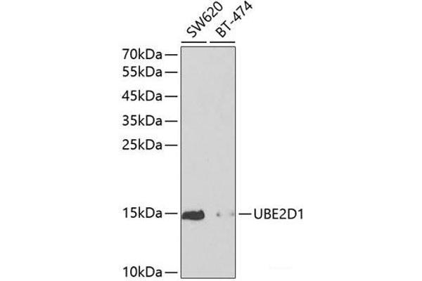 UBE2D1 anticorps