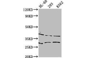 Western Blot Positive WB detected in: HL60 whole cell lysate, 293 whole cell lysate, K562 whole cell lysate All lanes: DMRT1 antibody at 1:2000 Secondary Goat polyclonal to rabbit IgG at 1/50000 dilution Predicted band size: 40, 29, 19 kDa Observed band size: 40 kDa