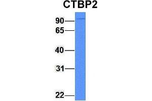 Host:  Rabbit  Target Name:  CTBP2  Sample Type:  Human Fetal Brain  Antibody Dilution:  1.